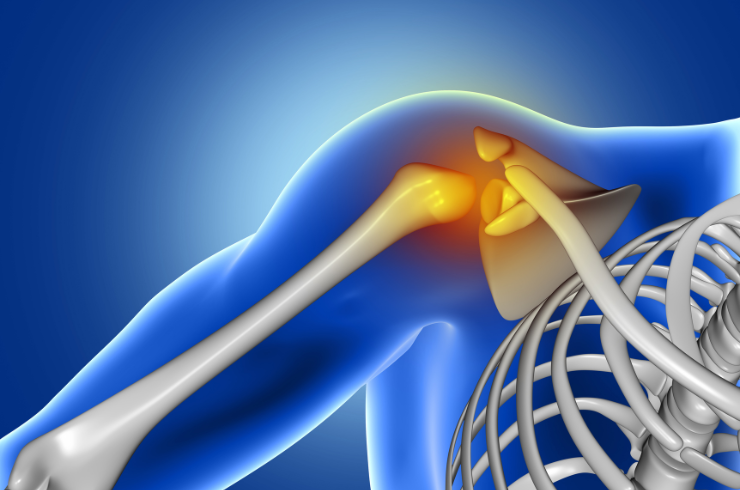 Benign Bone Tumors